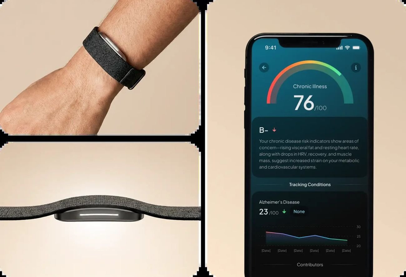 Hume Band on wrist and Hume Health app showing Chronic Illness risk score with tracked conditions